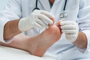 29766699 - doctor dermatologist examines the foot on the presence of athlete’s foot